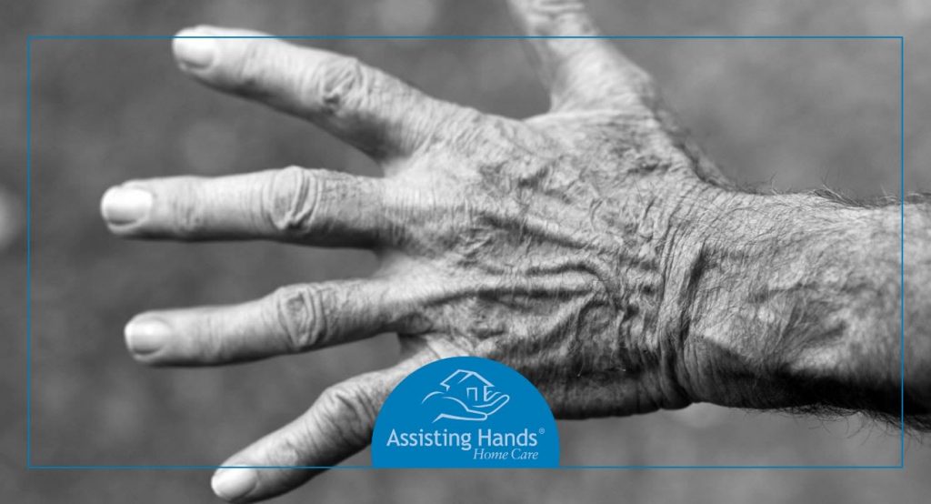 What Causes Bleeding Under the Skin in Seniors?